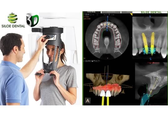 TAC 3D Radiovisiografía